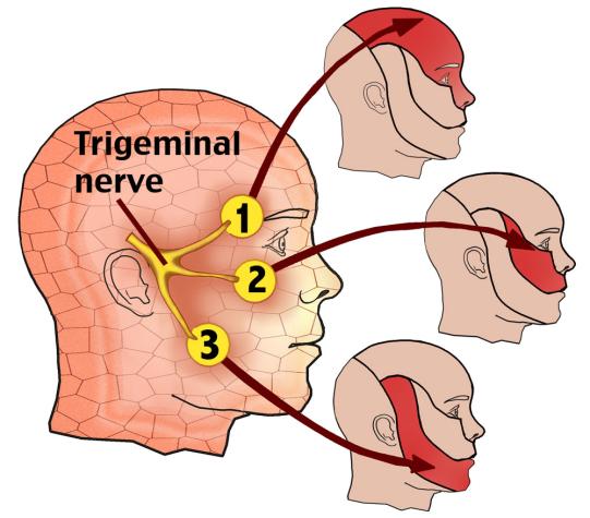 Hemifacial Spasm & Tics