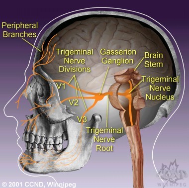 trigeminal neuralgia assessment hong kong